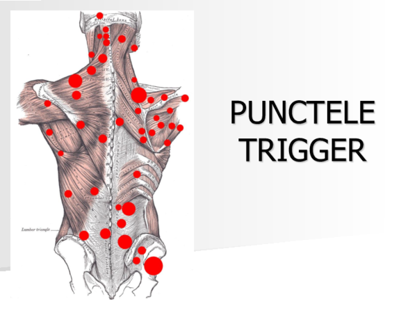 Curs de Terapia Punctelor Trigger
