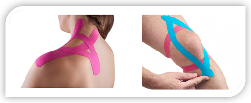 Kinezio Taping