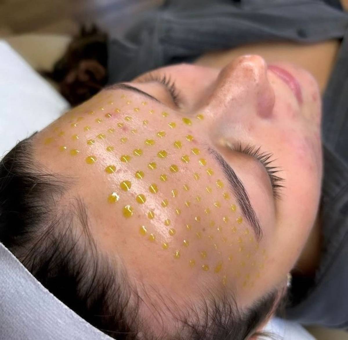 Curatire Faciala+BioRePeel